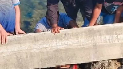 Bocah di Morotai Alami Luka Serius Usai Tertimpa Material Proyek