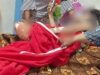 Potongan Kaki Manusia yang Ditemukan dalam Tempat Sampah di Ternate Diduga Hasil Amputasi