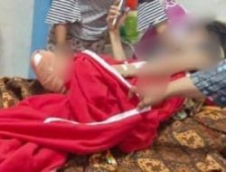 Potongan Kaki Manusia yang Ditemukan dalam Tempat Sampah di Ternate Diduga Hasil Amputasi