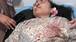 Anggota Brimob di Maluku Utara Diduga Aniaya Istri hingga Pingsan dan Dioperasi 